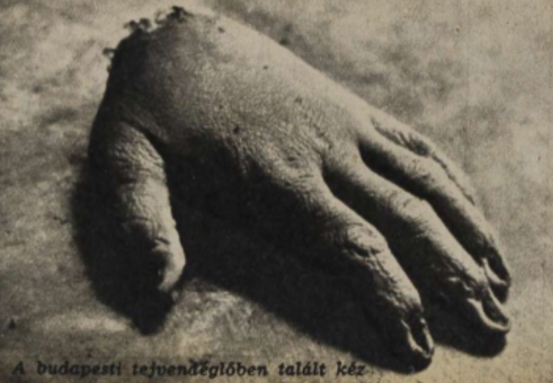 A Budapesten megtalált kézfej (Fotó: Arcanum - Rendőrségi Szemle)